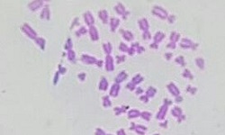 Giemsa stain